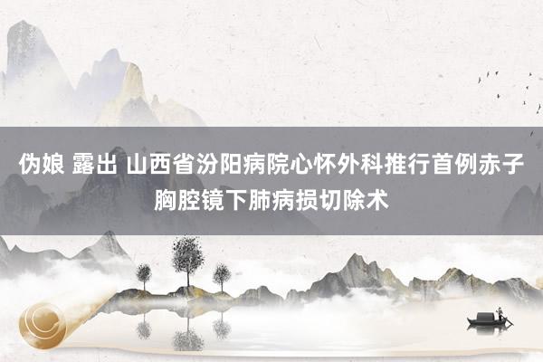 伪娘 露出 山西省汾阳病院心怀外科推行首例赤子胸腔镜下肺病损切除术